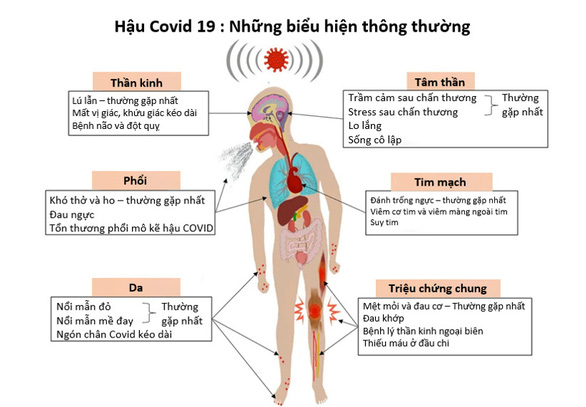 Bệnh nhân hội chứng COVID-19 kéo dài có nguy cơ bị tổn thương tim